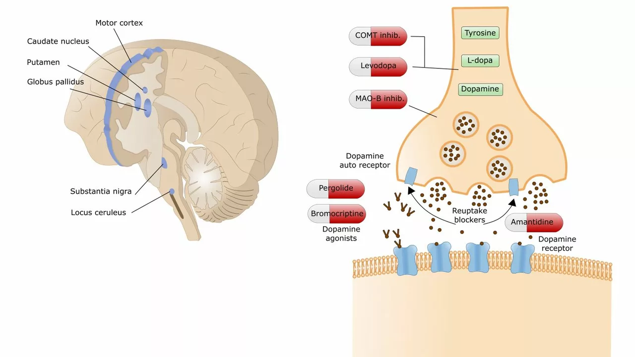 The potential benefits of betahistine for individuals with Parkinson's disease